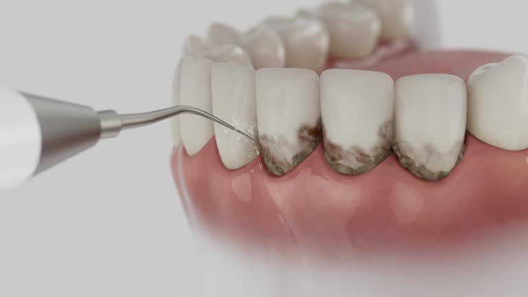 Trusted Dental Implants service in Mason Neck, VA - Dentist Open Now